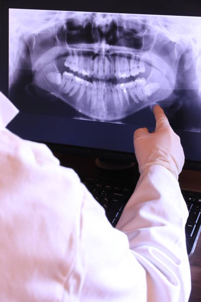 Best Emergency Dentist for Lost Fillings or Crowns in North Great River, NY
